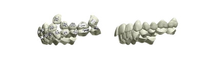 dijitalortodonti